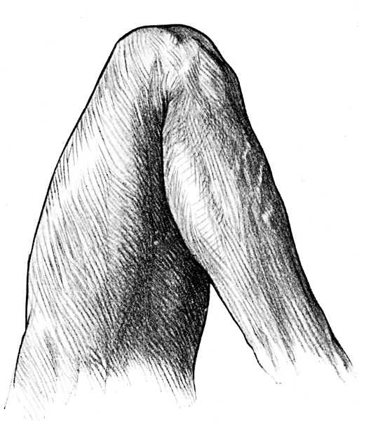 Knee Anatomy - The Flexed Knee