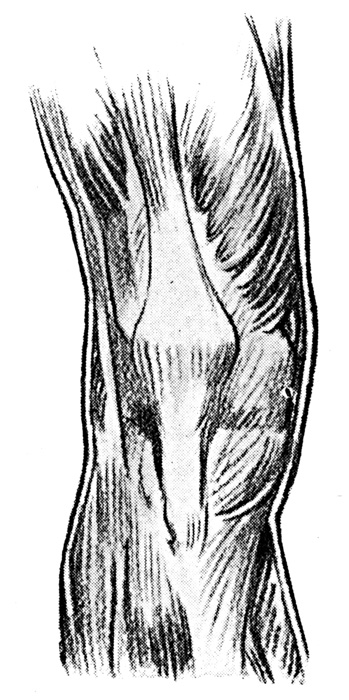 Knee Anatomy - Muscles on the Front of the Right Knee
