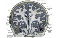 Diagrams Of The Human Brain 22