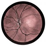 The Anatomy Of The Eye 19
