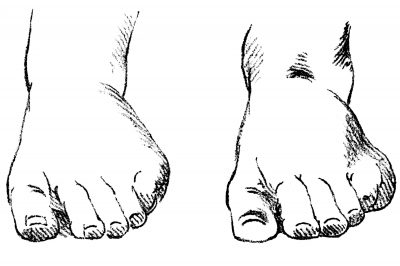 Drawings Of The Foot 10