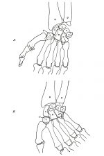 Diagrams Of The Hand 13