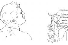 Anatomy Of The Neck And Throat 9